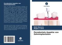 Produktbild: Parodontale Aspekte von Zahnimplantaten