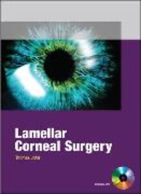 Produktbild: Lamellar Corneal Surgery