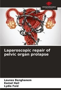 Produktbild: Laparoscopic repair of pelvic organ prolapse