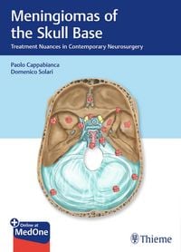 Produktbild: Meningiomas of the Skull Base