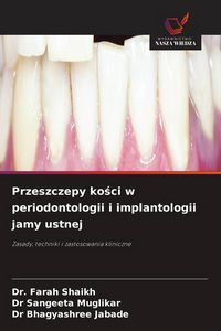 Produktbild: Przeszczepy ko&iquest;ci w periodontologii i implantologii jamy ustnej