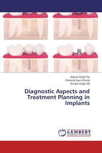 Produktbild: Diagnostic Aspects and Treatment Planning in Implants