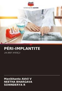 Produktbild: P&eacute;ri-Implantite