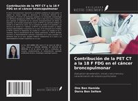Produktbild: Contribuci&oacute;n de la PET CT a la 18 F FDG en el c&aacute;ncer broncopulmonar