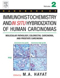 Produktbild: Handbook of Immunohistochemistry and in Situ Hybridization of Human Carcinomas