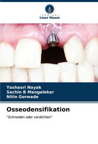 Produktbild: Osseodensifikation