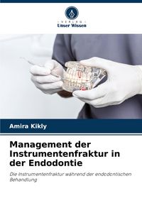 Produktbild: Management der Instrumentenfraktur in der Endodontie