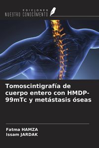 Produktbild: Tomoscintigraf&iacute;a de cuerpo entero con HMDP-99mTc y met&aacute;stasis &oacute;seas