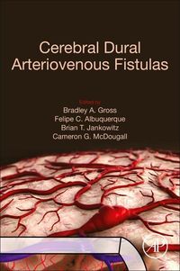 Produktbild: Cerebral Dural Arteriovenous Fistulas