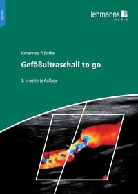 Produktbild: Gef&auml;&szlig;ultraschall to go