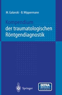 Produktbild: Kompendium der traumatologischen R&ouml;ntgendiagnostik
