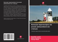 Produktbild: Remo&ccedil;&atilde;o laparosc&oacute;pica da jun&ccedil;&atilde;o pieloureteral em crian&ccedil;as