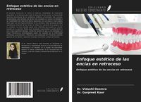 Produktbild: Enfoque est&eacute;tico de las enc&iacute;as en retroceso