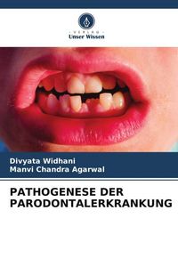 Produktbild: Pathogenese der Parodontalerkrankung