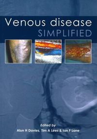 Produktbild: Venous Disease Simplified