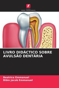 Produktbild: Livro Did&aacute;ctico Sobre Avuls&atilde;o Dent&aacute;ria