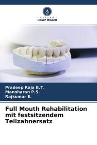Produktbild: Full Mouth Rehabilitation mit festsitzendem Teilzahnersatz