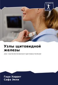 Produktbild: Uzly schitowidnoj zhelezy