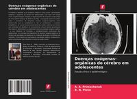 Produktbild: Doen&ccedil;as ex&oacute;genas-org&acirc;nicas do c&eacute;rebro em adolescentes