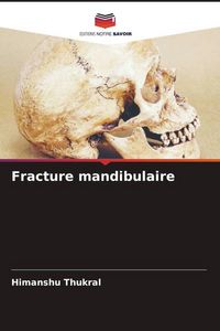 Produktbild: Fracture mandibulaire