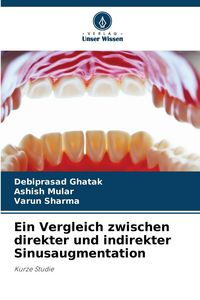 Produktbild: Ein Vergleich zwischen direkter und indirekter Sinusaugmentation