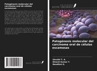 Produktbild: Patog&eacute;nesis molecular del carcinoma oral de c&eacute;lulas escamosas