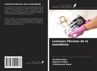 Produktbild: Lesiones fibrosas de la mand&iacute;bula