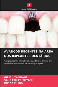 Produktbild: AVAN&Ccedil;OS RECENTES NA &Aacute;REA DOS IMPLANTES DENT&Aacute;RIOS