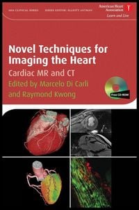 Produktbild: Novel Techniques for Imaging the Heart