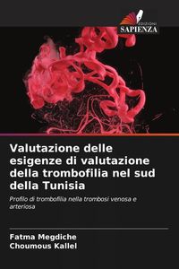Produktbild: Valutazione delle esigenze di valutazione della trombofilia nel sud della Tunisia
