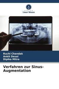 Produktbild: Verfahren zur Sinus-Augmentation