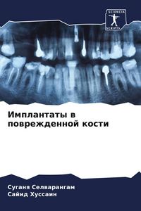 Produktbild: Implantaty w powrezhdennoj kosti