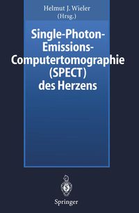 Produktbild: Single-Photon-Emissions-Computertomographie (SPECT) des Herzens