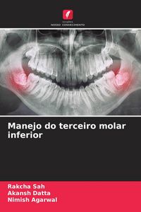 Produktbild: Manejo do terceiro molar inferior