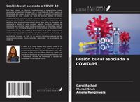 Produktbild: Lesi&oacute;n bucal asociada a COVID-19