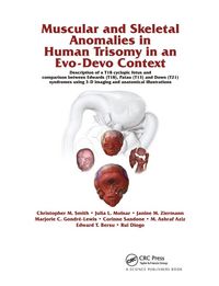 Produktbild: Muscular and Skeletal Anomalies in Human Trisomy in an Evo-Devo Context