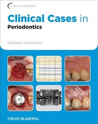 Produktbild: Clinical Cases in Periodontics