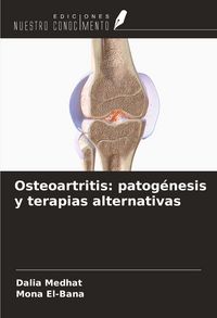 Produktbild: Osteoartritis: patog&eacute;nesis y terapias alternativas