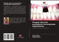 Produktbild: Progr&egrave;s dans les proc&eacute;dures chirurgicales implantaires