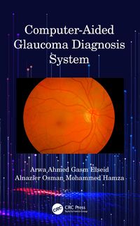 Produktbild: Mohammed Hamza, A: Computer-Aided Glaucoma Diagnosis System