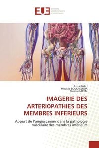 Produktbild: Imagerie des Arteriopathies des Membres Inferieurs