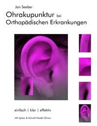 Produktbild: Ohrakupunktur bei Orthop&auml;dischen Erkrankungen