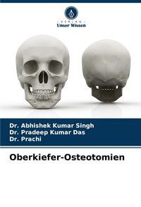 Produktbild: Oberkiefer-Osteotomien