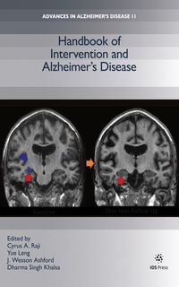 Produktbild: Handbook of Intervention and Alzheimer's Disease