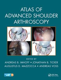Produktbild: Atlas of Advanced Shoulder Arthroscopy