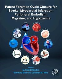 Produktbild: Patent Foramen Ovale Closure for Stroke, Myocardial Infarction, Peripheral Embolism, Migraine, and Hypoxemia