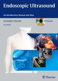 Produktbild: Endoscopic Ultrasound