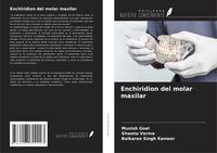 Produktbild: Enchiridion del molar maxilar