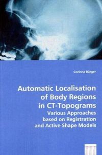 Produktbild: Lokalisierung von K&ouml;rperregionen in CT-Topogrammen