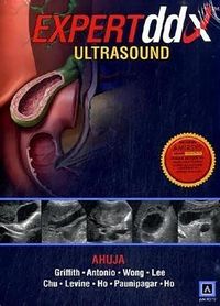 Produktbild: Expertddx Ultrasound